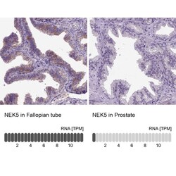 NEK5 Antibody, Novus Biologicals 0.1 mL | Buy Online | Novus Biologicals | Fisher Scientific